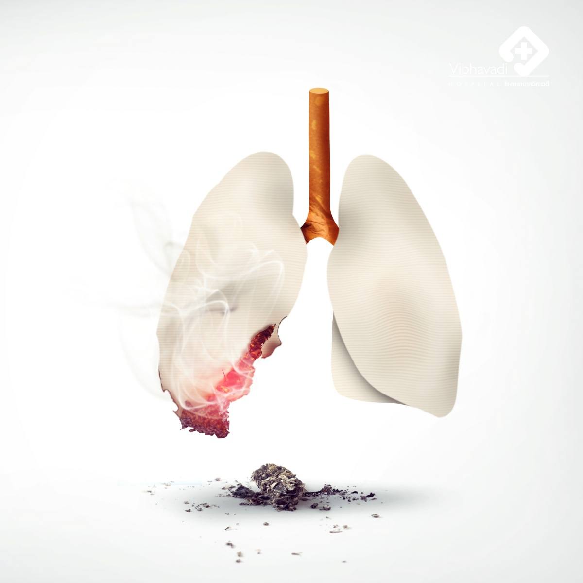 รู้จักมะเร็งปอด (Lung Cancer) ภัยเงียบที่คร่าชีวิตคนไทยอันดับต้นๆ