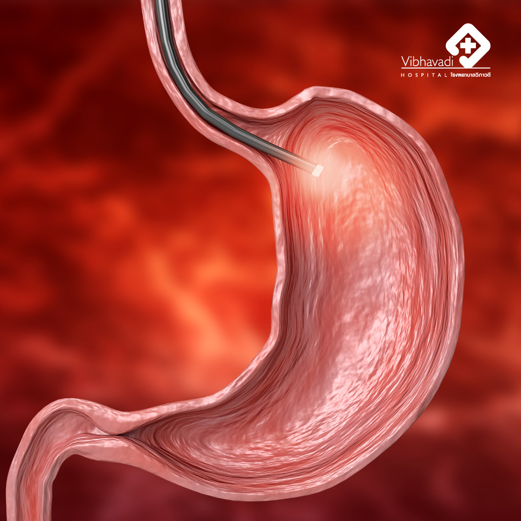 Upper Gastrointestinal Endoscopy : Esophagogastroduodenoscopy