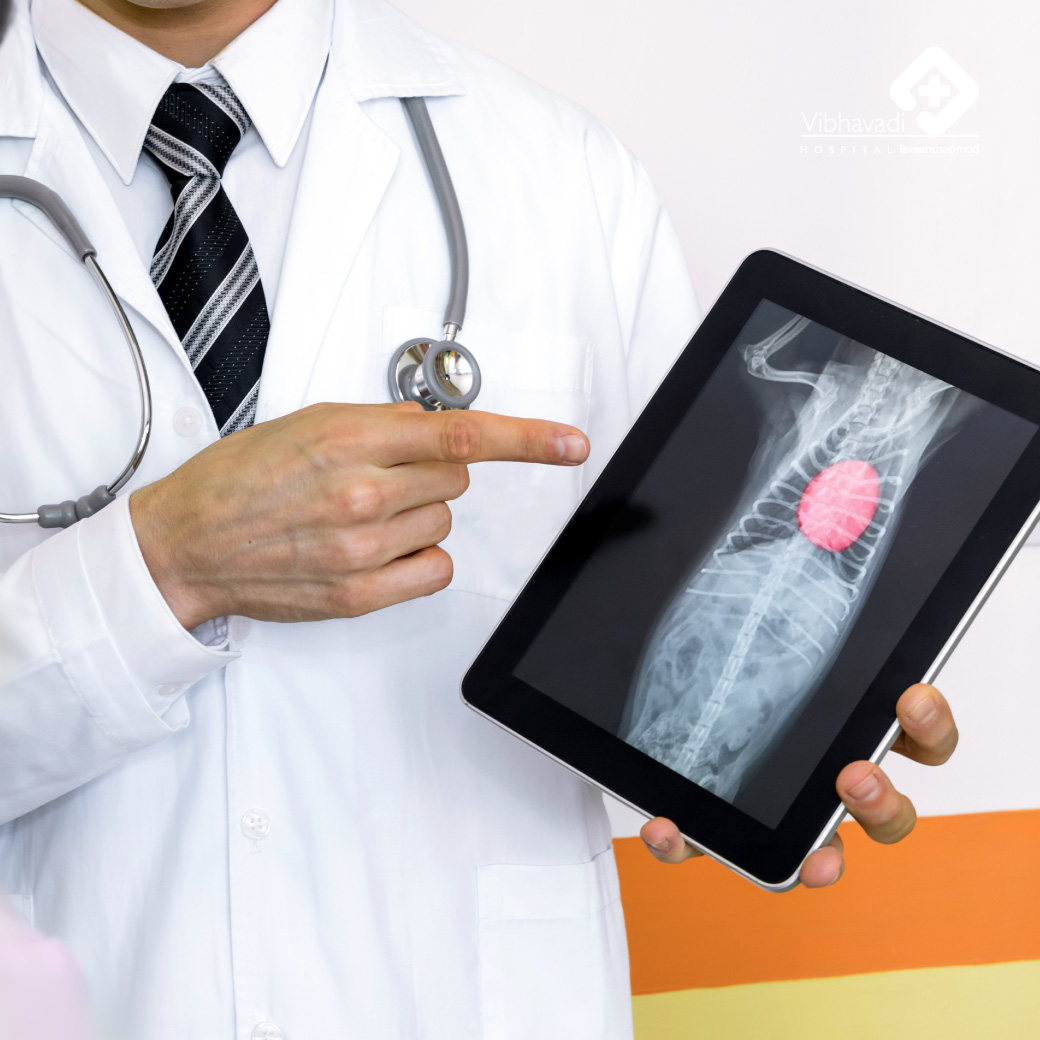 Diagnosing an enlarged heart with the echocardiogram