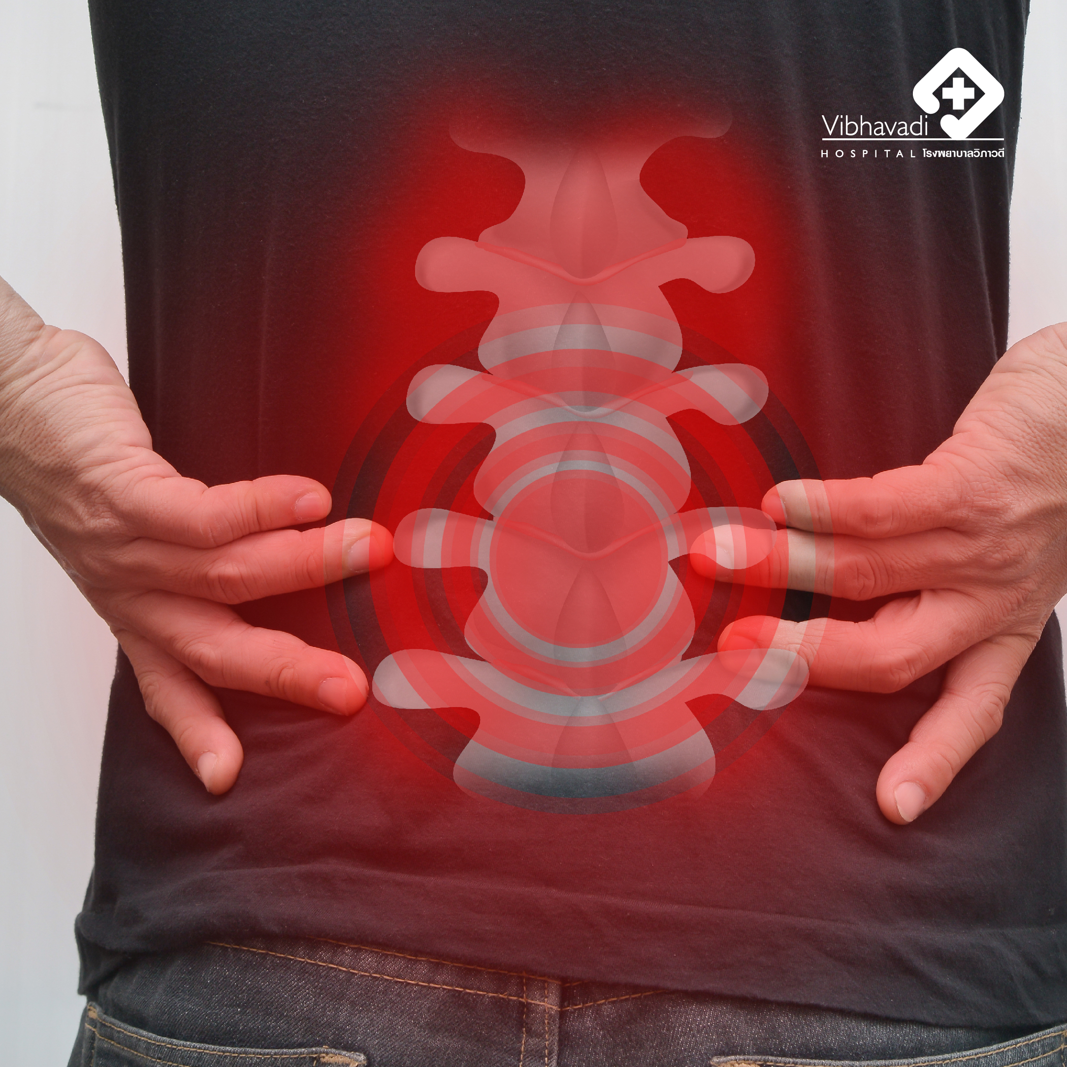 Ankylosing Spondylitis