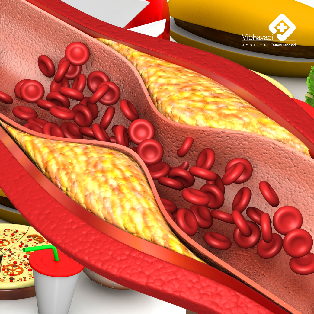 ความรู้เรื่องไขมันในเส้นเลือด