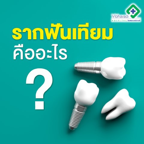 รากฟันเทียม คืออะไร