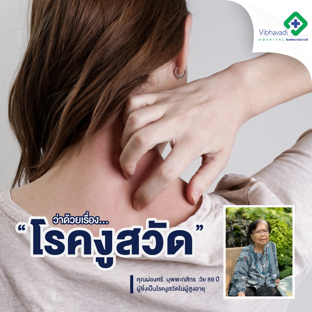 โรคงูสวัด แชร์ประสบการณ์จริง อันตรายมากในผู้สูงอายุ: อาการยังไง & รักษาวิธีไหน